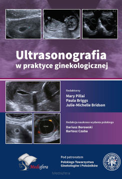 Ultrasonografia w praktyce ginekologicznej