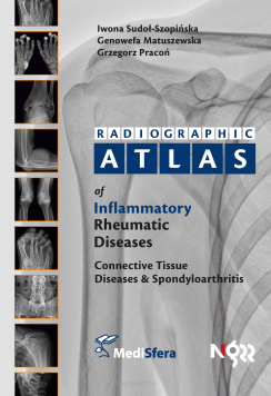 Radiographic Atlas of Inflammatory Rheumatic Diseases