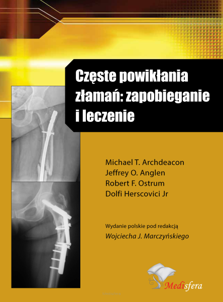 Częste powikłania złamań: zapobieganie i leczenie.