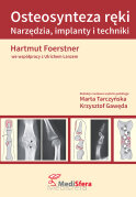 Osteosynteza ręki. Narzędzia, implanty i techniki