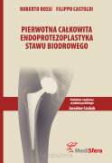 Pierwotna całkowita endoprotezoplastyka stawu biodrowego